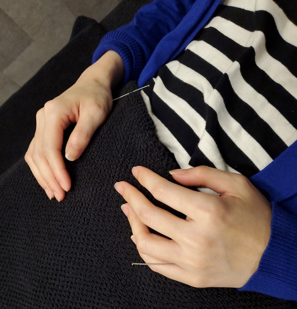 鍼治療、美容鍼もしている、あやめ整骨院です!!
