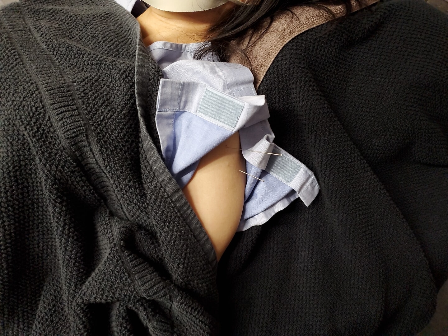 鍼治療、美容鍼もしている、あやめ整骨院です!!
